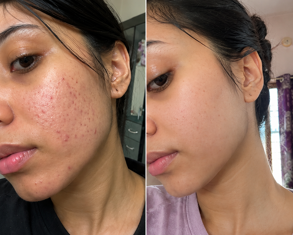 Before and after result
